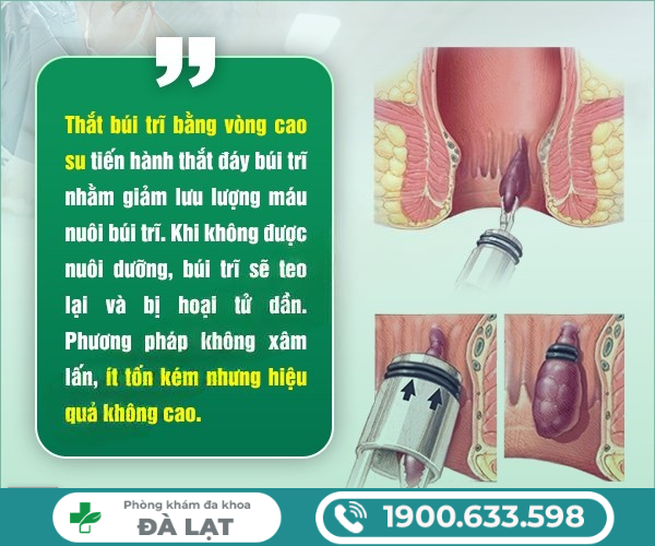 Hình ảnh minh họa